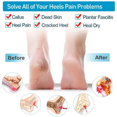 Silicone Heel Pads, Anti Crack Heel Protector, Heel Protectors Set, Silicone Half Heel Anti Crack Covers, Silicone Moisturizing Gel Heel Anti-Crack Socks